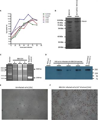 Preclinical evaluation of safety and immunogenicity of a primary series intranasal COVID-19 vaccine candidate (BBV154) and humoral immunogenicity evaluation of a heterologous prime-boost strategy with COVAXIN (BBV152)